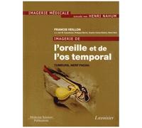 Imagerie De L'oreille Et De L'os Temporal - Tome 4, Tumeurs, Nerf Facial