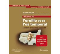Imagerie de l'oreille et de l'os temporal - Volume 1. Anatomie et imagerie normales - Henri Nahum - Medecine Science Publications - broché - Scolaire / Universitaire