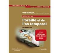 Imagerie de l'oreille et de l'os temporal - Volume 2. Inflammation Henri Nahum (Auteur), Jan W. Casselman (Auteur), Francis Veillon (Auteur)