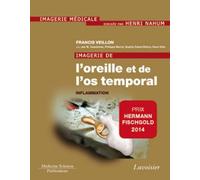 Imagerie de l'oreille et de l'os temporal - Volume 2. Inflammation: Volume 2. Inflammation