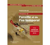 Imagerie de l'oreille et de l'os temporal - Volume 3. Traumatologie, urgences, otospongiose: Volume 3. Traumatologie, urgences, otospongiose