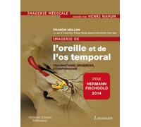 Imagerie de l'oreille et de l'os temporal - Volume 3. Traumatologie, urgences, otospongiose: Volume 3. Traumatologie, urgences, otospongiose