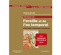 Imagerie de l'oreille et de l'os temporal - Volume 6. Symptômes, innovations techniques Henri Nahum (Auteur), Jan W. Casselman (Auteur), Francis Veillon (Auteur)