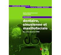 Imagerie Dentaire, Sinusienne Et Maxillofaciale - Du Cone Beam À L'irm