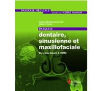 Imagerie dentaire, sinusienne et maxillofaciale Henri Nahum (Auteur), Claude Hodez (Auteur), Nadine Martin-Duverneuil (Auteur)
