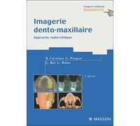 Imagerie dento-maxillaire Approche radio-clinique - Robert Cavézian - Elsevier Masson - broché - Essai