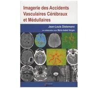 Imagerie Des Accidents Vasculaires Cérébraux Et Médullaires