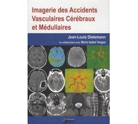 Imagerie Des Accidents Vasculaires Cérébraux Et Médullaires