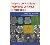 IMAGERIE DES ACCIDENTS VASCULAIRES CEREBRAUX ET MEDULLAIRES