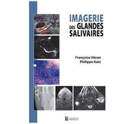 Imagerie Des Glandes Salivaires