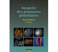 Imagerie Des Grossesses Gémellaires