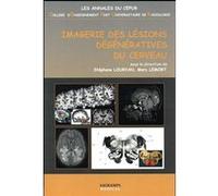 Imagerie des lesions degeneratives du cerveau Marc Lemort (Direction), Stéphane Louryan (Direction), LELORT MARC LOURYAN STEPHANE (Auteur)
