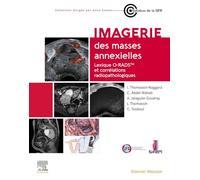 Imagerie des masses annexielles: Lexique O-RADS et corrélations radiopathologiques