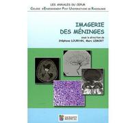Imagerie des meninges - annales du cepur Annales du CEPUR - Marc Lemort - Sauramps Medical - broché - Scolaire / Universitaire