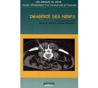 Imagerie des nerfs cepur Michel G. Dupuis (Direction), Philippe Peetrons (Direction), R DUPUIS (Auteur)