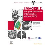 Imagerie des pneumopathies interstitielles diffuses (PID) - Samia Boussouar - Elsevier Masson - broché - Scolaire / Universitaire