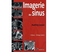 IMAGERIE DES SINUS