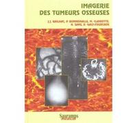 Imagerie des tumeurs osseuses Collectif (Auteur)