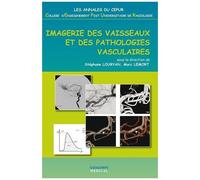 Imagerie Des Vaisseaux Et Des Pathologies Vasculaires