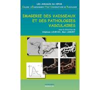 Imagerie des vaisseaux et des pathologies vasculaires Stéphane Louryan (Auteur)