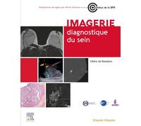 Imagerie diagnostique du sein - Cédric de Bazelaire - Elsevier Masson - broché - Scolaire / Universitaire