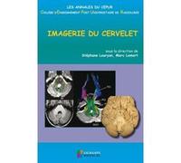Imagerie du cervelet Stéphane Louryan (Auteur), Marc Lemort (Auteur)