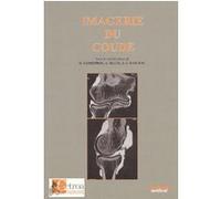 Imagerie du coude