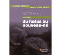 Imagerie : du foetus au nouveau-né