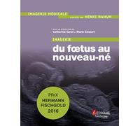 Imagerie : du foetus au nouveau-né