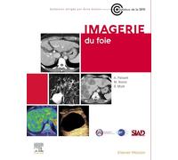 Imagerie du foie