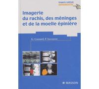 Imagerie du rachis, des méninges et de la moelle épinière