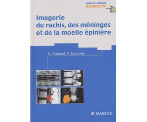 Imagerie du rachis, des méninges et de la moelle épinière