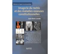 Imagerie du rachis et des maladies osseuses constitutionnelles Rachis de l'adulte et maladies osseuses de l'enfant vues à l'âge adulte - Jean-Daniel Laredo - Sauramps Medical - broché - Scolaire / Uni