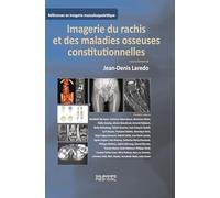 Imagerie du rachis et des maladies osseuses constitutionnelles: Rachis de l'adulte et maladies osseuses de l'enfant vues à l'âge adulte