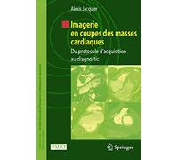 Imagerie en coupes des masses cardiaques: Du protocole d'acquisition au diagnostic