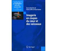 Imagerie en coupes du coeur et des vaisseaux - Collectif - Springer Vienne - Poche - Scolaire / Universitaire