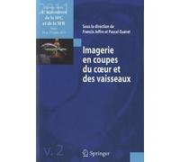 Imagerie En Coupes Du Coeur Et Des Vaisseaux - Edition 2011
