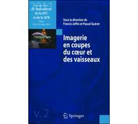 Imagerie en coupes du coeur et des vaisseaux