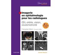 Imagerie en ophtalmologie pour les radiologues: Oeil, orbite, vision, oculomotricité