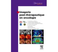Imagerie post-thérapeutique en oncologie