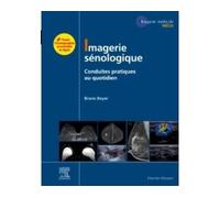 Imagerie sénologique Conduites pratiques au quotidien - Professeur Bruno Boyer - Elsevier Masson - broché - Scolaire / Universitaire