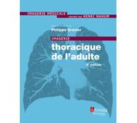 Imagerie thoracique de l'adulte (4° Éd.)