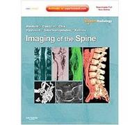 Imaging of the Spine, Expert Radiology Series Charles Raybaud, James G. Smirniotopoulos, Mauricio Castillo, Thomas P. Naidich (Auteur)