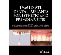 Implants dentaires immédiats – Sites esthétiques et prémolaires – Wiley-VCH