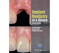 Implant Dentistry at a Glance