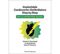 Implantable Cardioverter-Defibrillators Step by Step: An Illustrated Guide