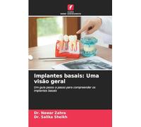 Implantes basais: Uma visão geral