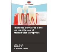 Implants dentaires dans les maxillaires et mandibules atrophiés