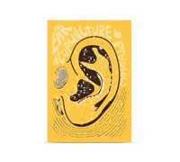 Impression D’Acupuncture De L’Oreille, Acupuncture Auriculaire, Médecine Traditionnelle Chinoise, Anatomie De L’Oreille Affiche D’Éducation Médicale Impression Sur Toile A1 50Cmx70Cm Sans Cadre