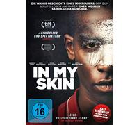 In My Skin – avec Kate Beckinsale, Dagleish, John Idris, Damson Winstone, Jaime Gugu – DVD – Import